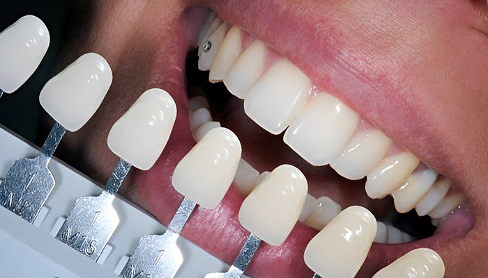Tooth Jewelry