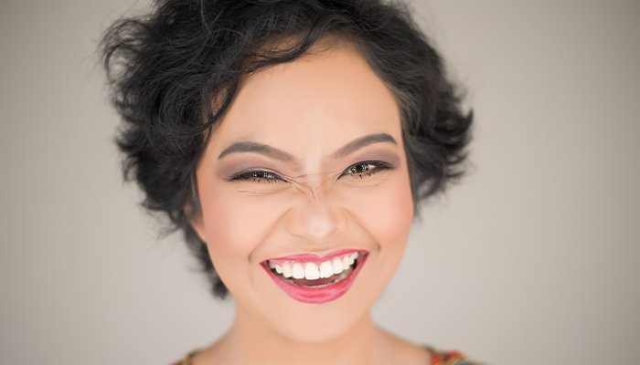 Emax Veneers